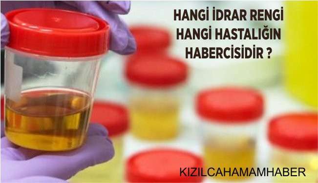 Hangi İdrar Rengi Hangi Hastalığın Habercisidir ?